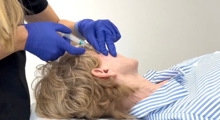 Sculptra in Bishops Waltham